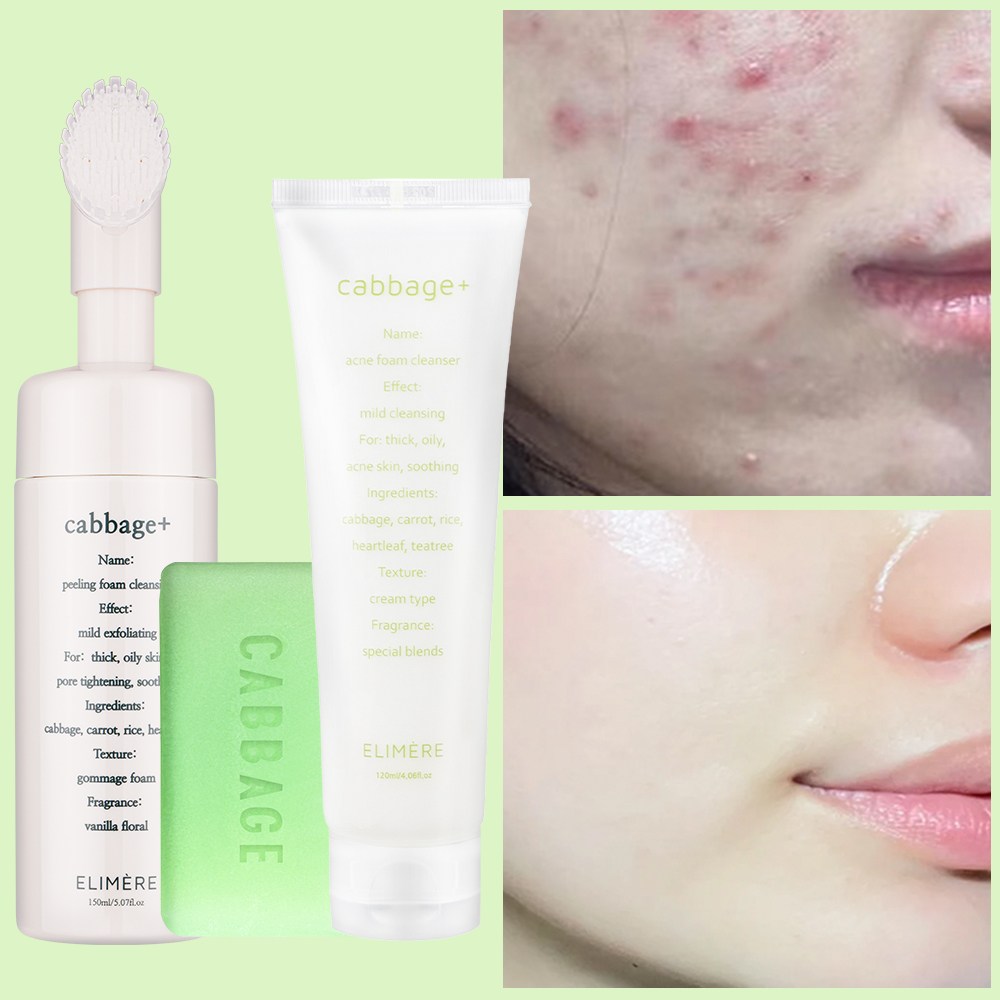 캐비지 아크네 여드름기능성 클렌징 세트, 1세트 49,500원