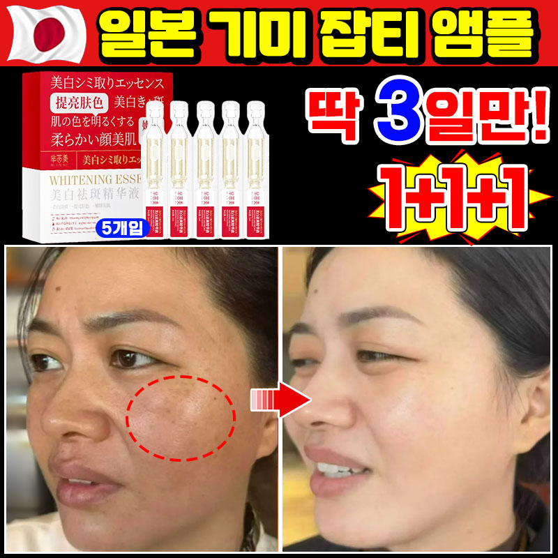 [100% 효과있음] 1/1+1/2+2 기미 미백 앰플 잡티 주근깨 검버섯 제거 세럼 비타민c 앰플 멜라논 에선스 화이트닝 색소침착 14,800원