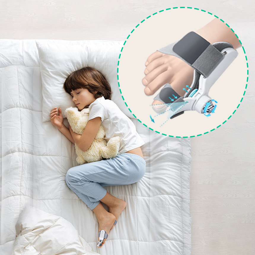 [미국 FDA 등록] 엠피케어 무지외반증 발가락 교정기 의료기기 개인 맞춤형, 1개 65,000원